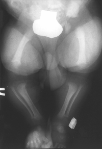 Achondroplasie Hinterläufe Pudel